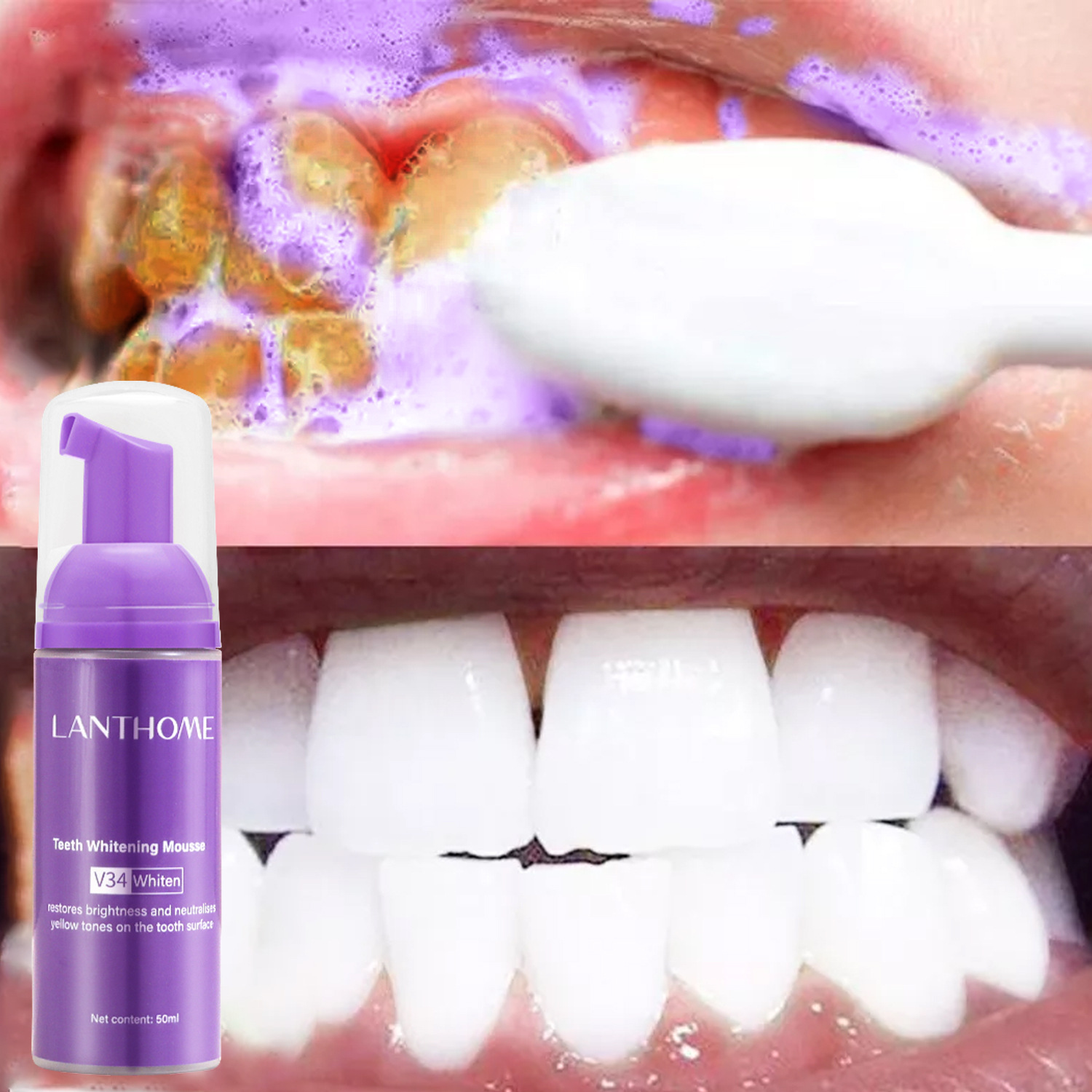 Teeth Whitening/Bleaching - V34 Tanden Whitening Mousse Tandpasta Verwijderen