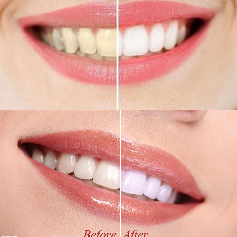 Bamboe Houtskool Tanden Dental - Teeth Whitening Remedies recensie en prijs