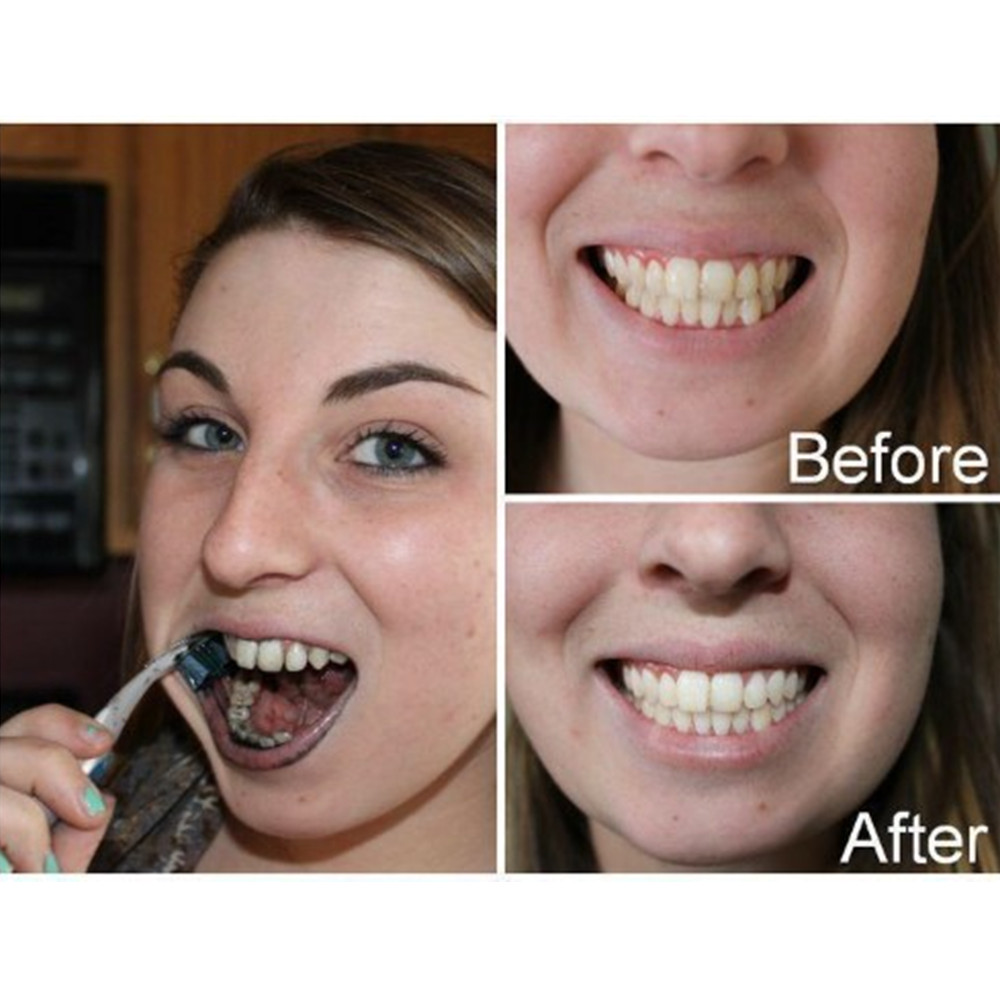 Bamboe Houtskool Tanden Dental - Teeth Whitening Remedies recensie en prijs
