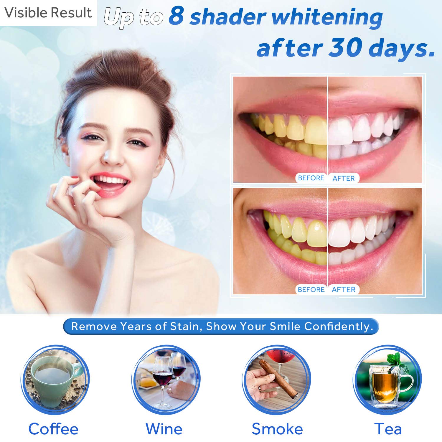 Tanden Whitening Gel Refill Sp - Teeth Whitening Session recensie en prijs