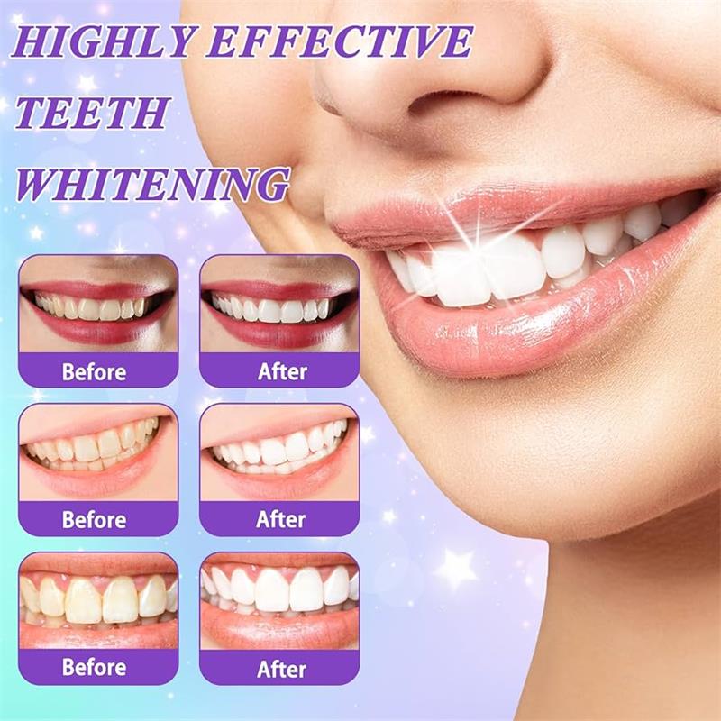 9D Paarse Tandenbleek Tandpast - Teeth Whitening Naturally recensie en prijs