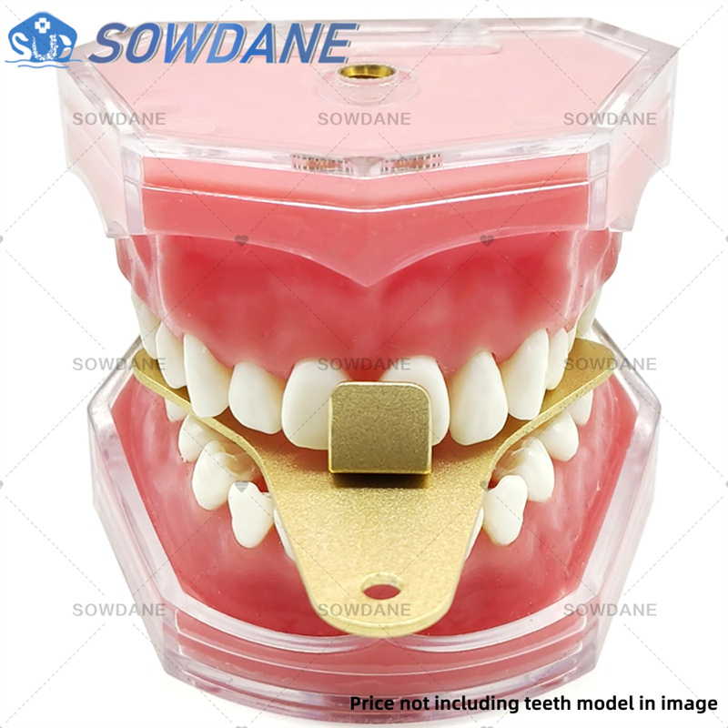 Dental Lab Afdruklepels om Cen - Teeth Whitening Tray recensie en prijs