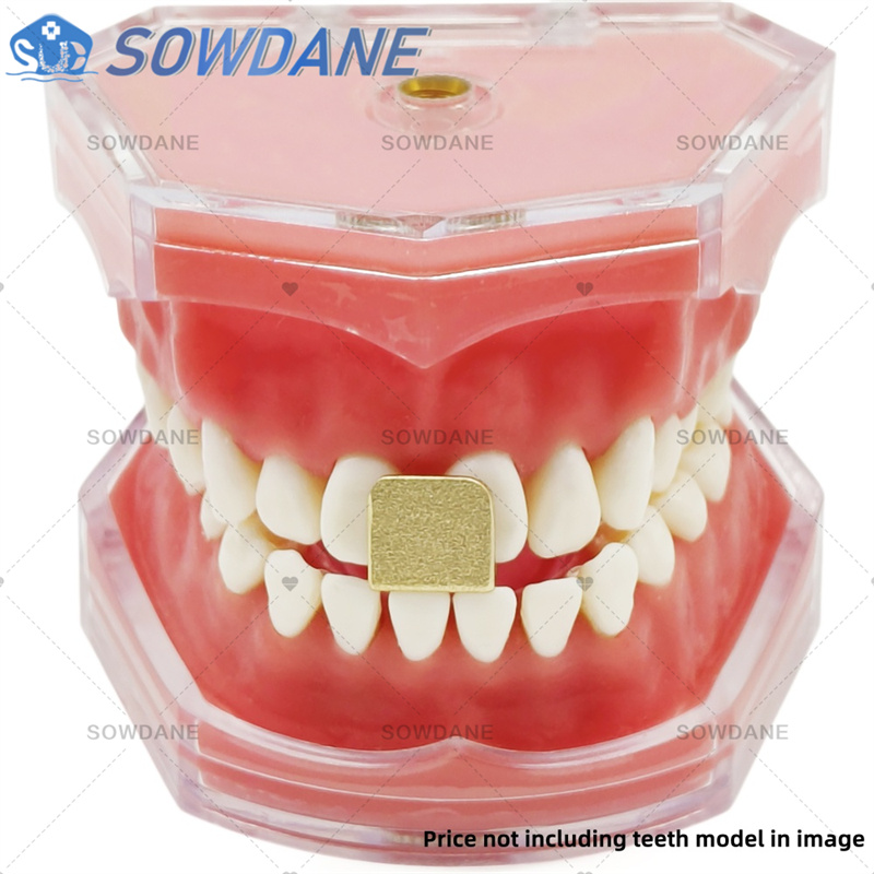Dental Lab Afdruklepels om Cen - Teeth Whitening Tray recensie en prijs