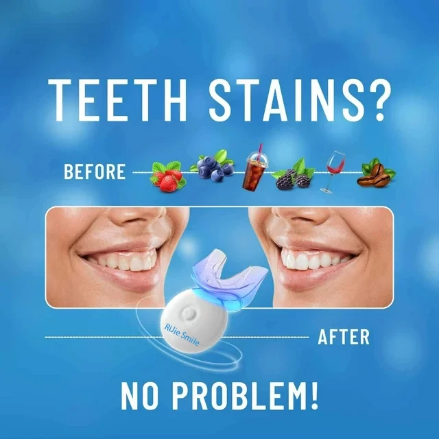 Hoogwaardige reinigingsset dra - Teeth Whitening At Home Kit recensie en prijs