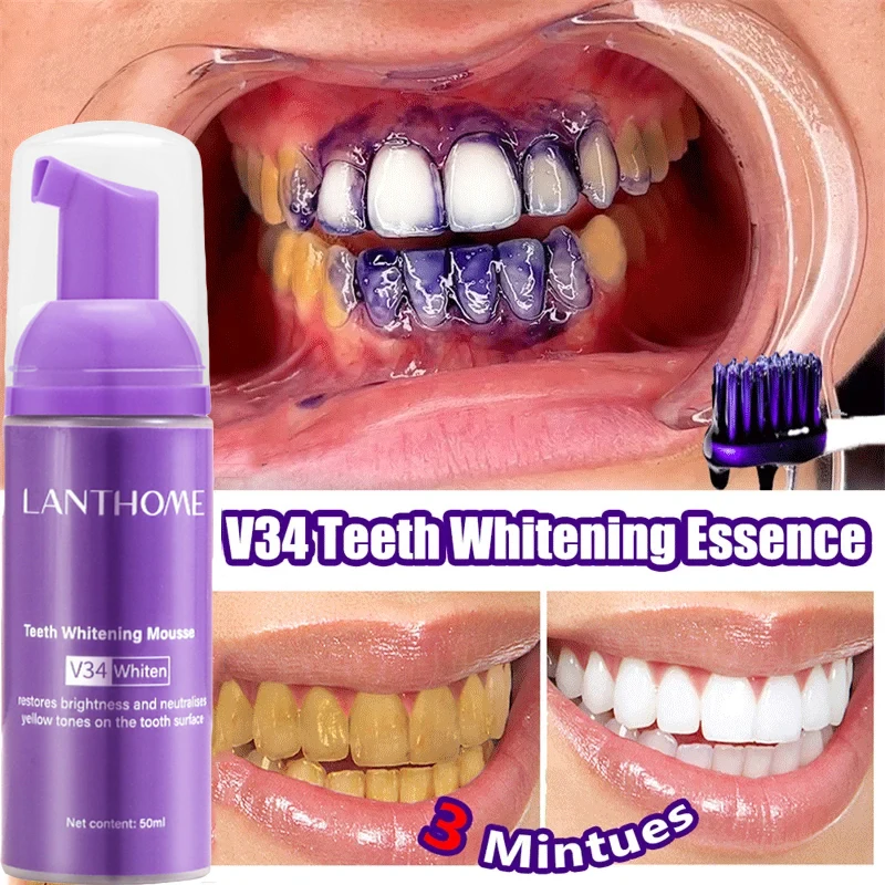 V34 Tanden Whitening Mousse Ta - Teeth Whitening/Bleaching recensie en prijs