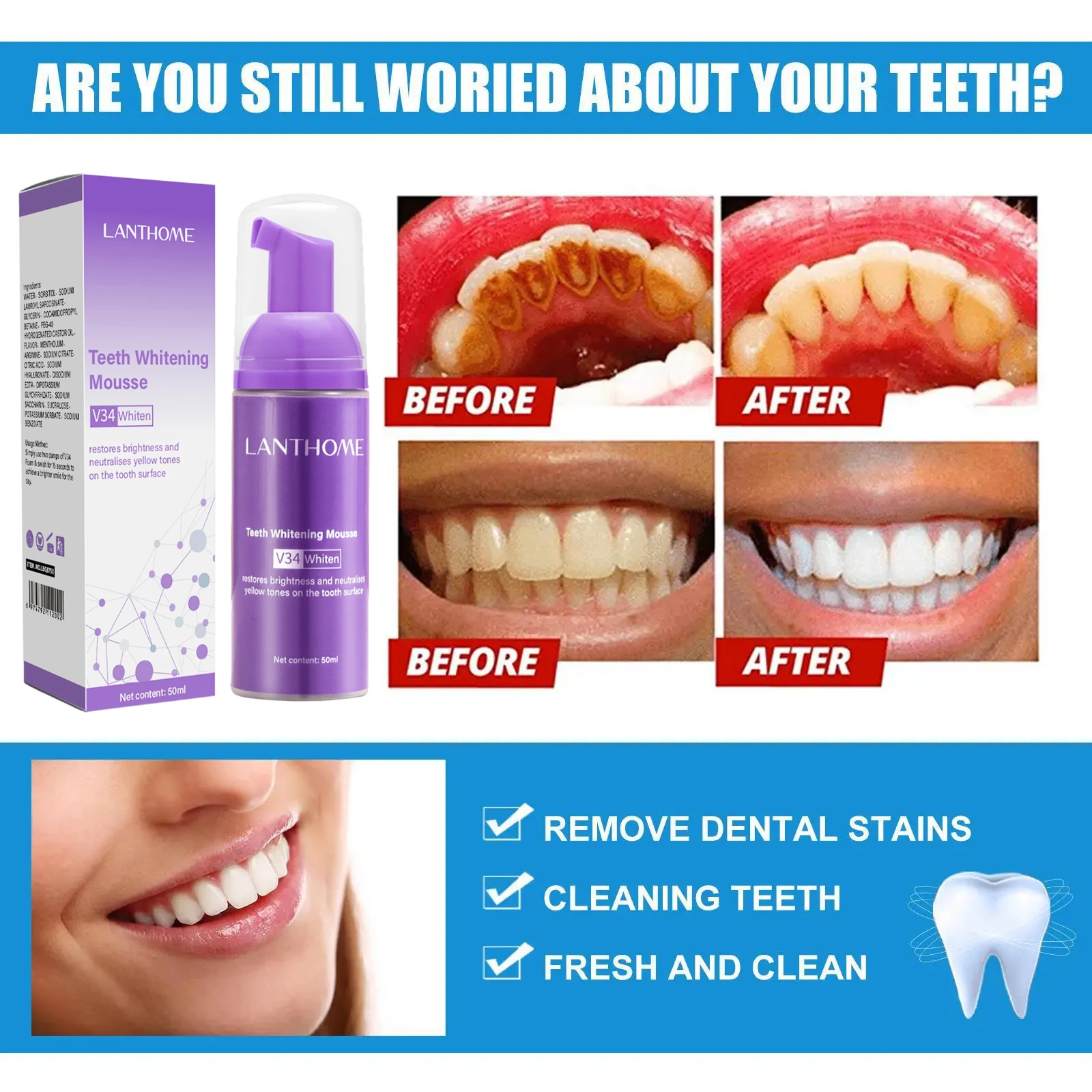 V34 Tanden Whitening Mousse Ta - Teeth Whitening/Bleaching recensie en prijs