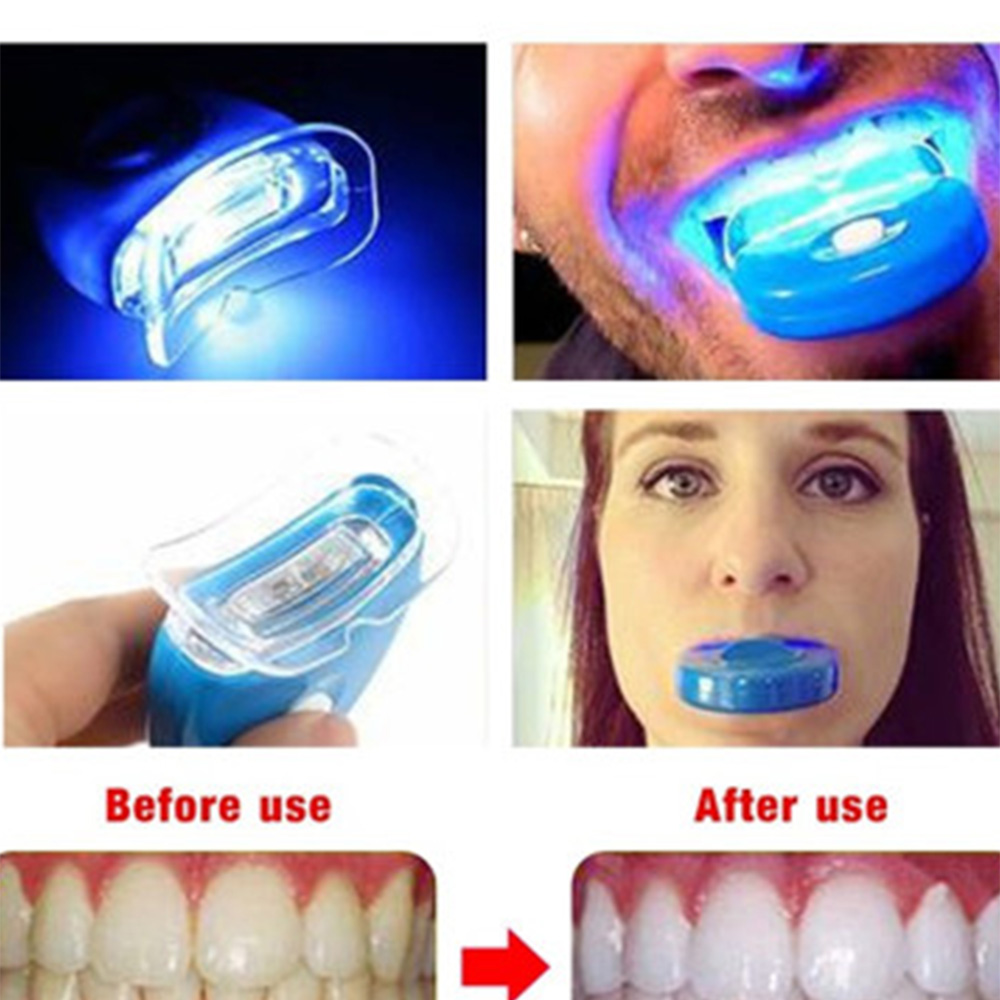 Nieuwe Blauwe Led Tanden Bleke - Teeth Whitening Uv Kit recensie en prijs