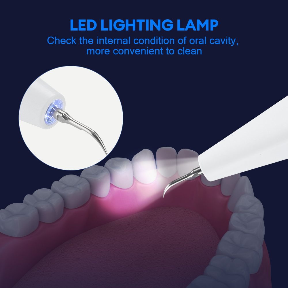 Ultrasone tandsteenverwijderaa - Teeth Whitening Tips recensie en prijs